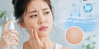 Vì sao xịt khoáng mỗi ngày nhưng da vẫn khô căng?