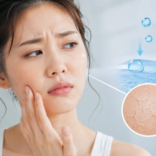 Vì sao xịt khoáng mỗi ngày nhưng da vẫn khô căng?