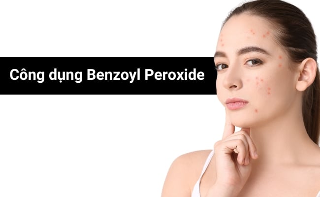 công dụng của benzoyl peroxide là gì