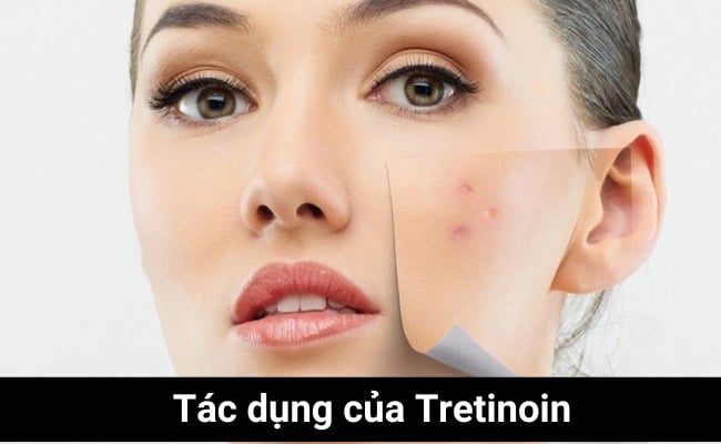 tác dụng của tretinoin