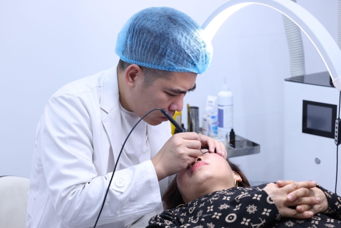 Chuyên gia Thành Nguyễn cho biết phương pháp laser hoặc chấm TCA hỗ trợ trị nám, tàn nhang. Ảnh: NVCC
